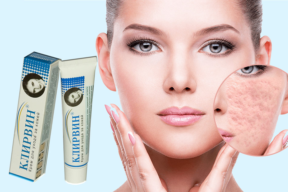 kem trị sẹo nga loại tốt