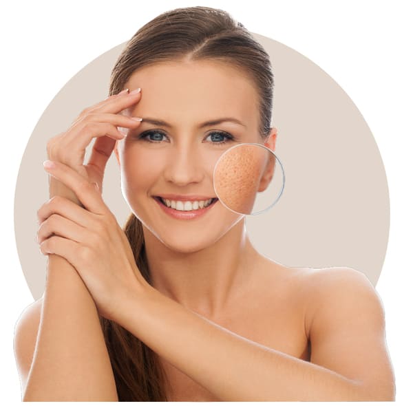 kem trị sẹo nga loại tốt