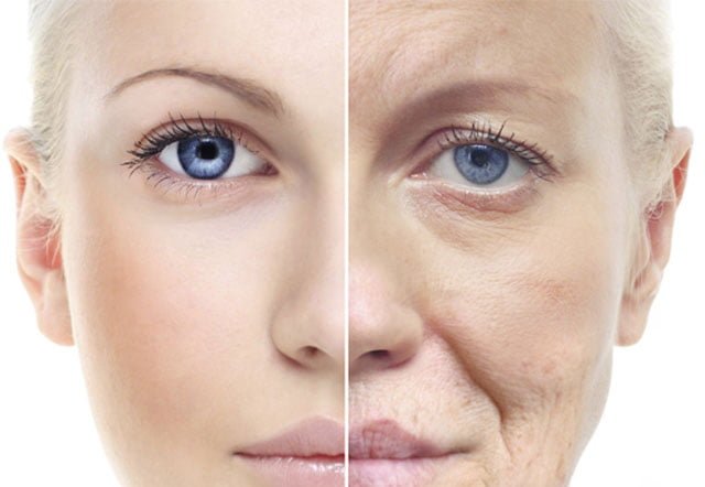 Nguyên nhân khiến da bị lão hóa